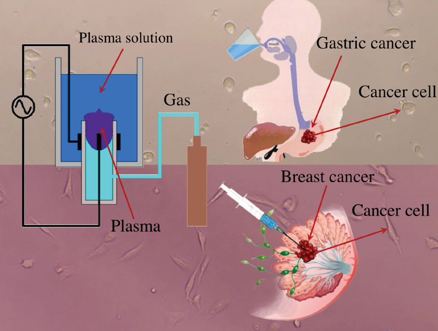 Cold plasma. Cold atmospheric Plasma. Plasma Medicine. The Effect of Cold Plasma on tumor Cells. Cold Plasma China tube.