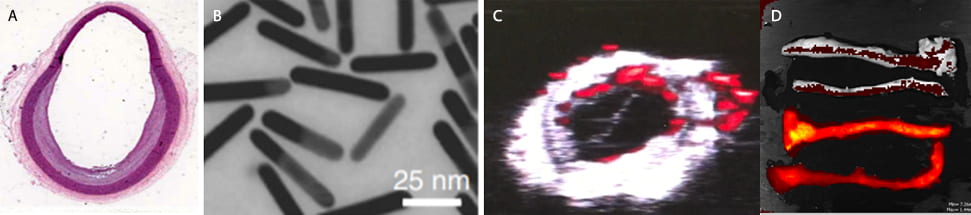 gold nanorods and indocyanine green images