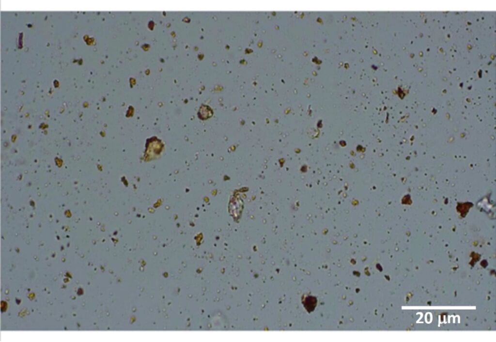 Polarized light microscopy