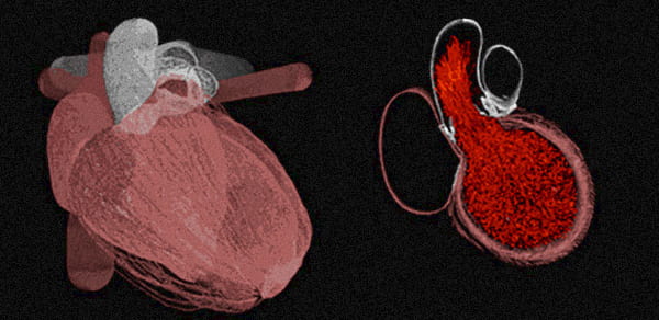 3D rendering of the human heart