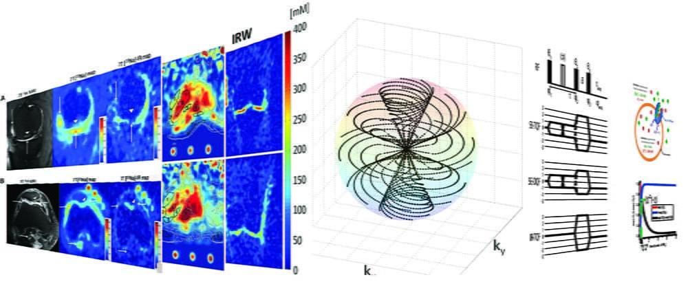 MRI imaging methodology