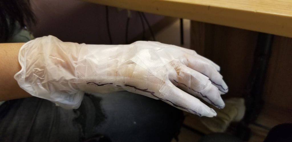 SURGICAL GLOVE PLACED ON YOUNG FEMALE HAND AND WRAPPED WITH SURGICAL TAPE. BLACK MARKER USED TO DRAW ON ULNAR ASPECT OF HAND AND CUT ALONG THE MARK TO REMOVE THE GLOVE WHICH IS NOW A 3D MOLD OF THE PATIENT’S HAND