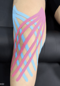 Pink and pre-cut blue kinesio tape on a forearm.